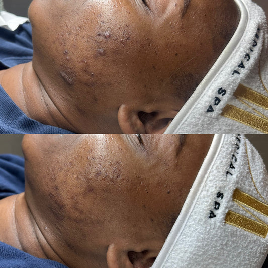 Your privacy choices 3