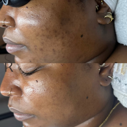 Before and Afters 13