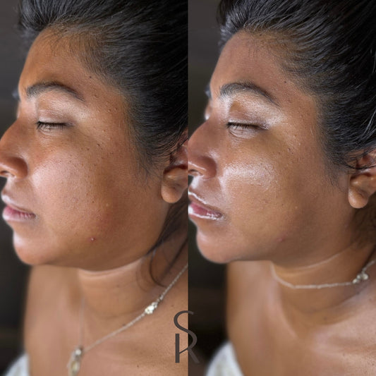 Before and Afters 10