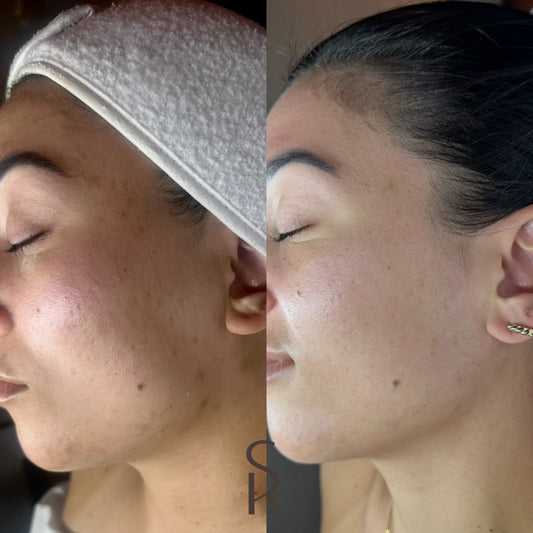 Before and Afters 11