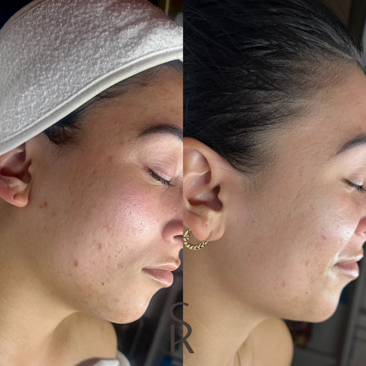 Before and Afters 12